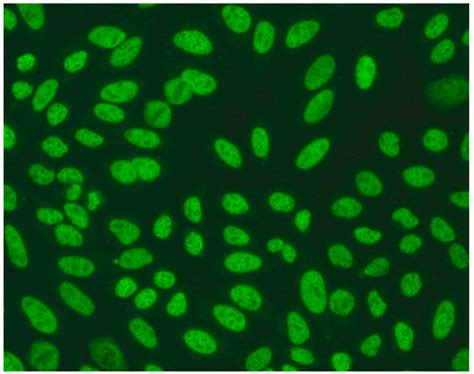 The Art of Interpreting Antinuclear Antibodies (ANAs) in Everyday Practice