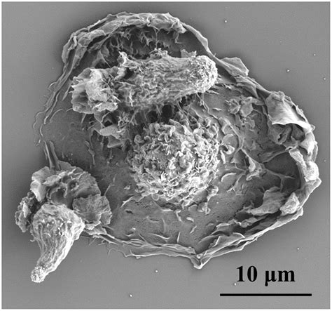 TGF-β Sustains Tumor Progression through Biochemical and Mechanical ...