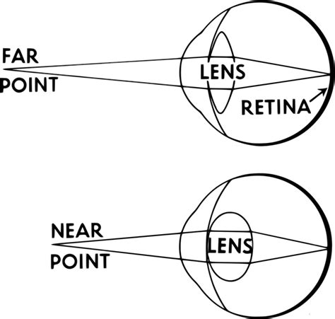 Ocular Accommodation - Refraction - Neurology - Teachmephysiology