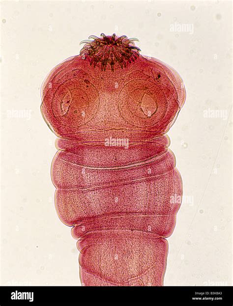 PORK TAPEWORM (TAENIA SOLIUM) SHOWING THE HEAD OR SCOLEX, SUCKERS AND HOOKS 50X Stock Photo - Alamy