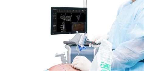 Computer Surgery 的图像结果