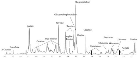 Metabolic Portraits of Breast Cancer by HR MAS MR Spectroscopy of ...
