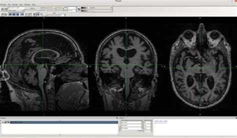 Image result for How to Digitize FSL