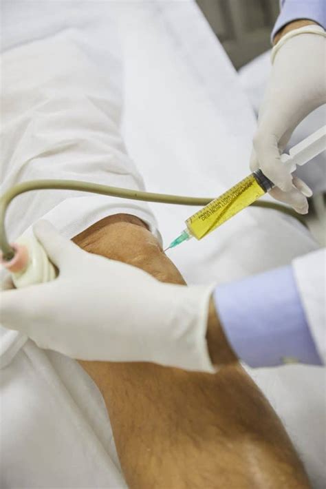 Cell Injection 的图像结果