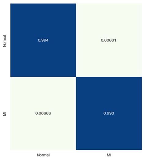 ECG Heartbeat Classification Using CONVXGB Model