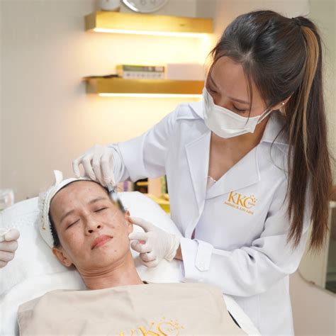 Image result for Thread Lift