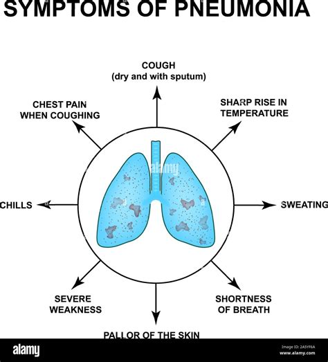 Pneumonia Lungs Disease Vector Infographics On Symptoms