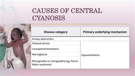 Overview of cyanosis in the newborn | PPTX