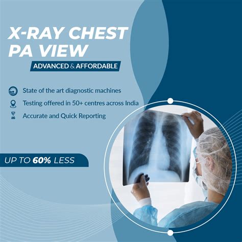 What Is Pa View In X Ray at Layla Warner blog