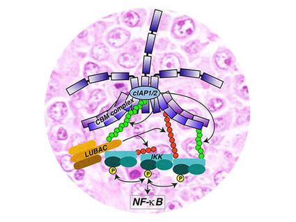 Acalabrutinib Receives FDA Approval for Mantle Cell Lymphoma - NCI