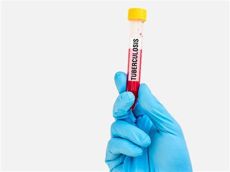 AJ Hospital and Research Centre