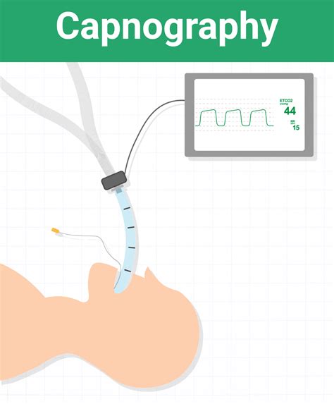 Graphy Definition Medical