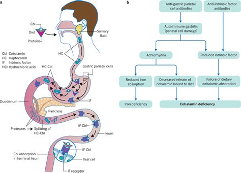 Pernicious anaemia | The BMJ