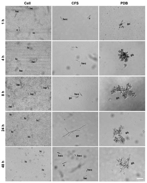 A Potent Burkholderia Endophyte against Boxwood Blight Caused by ...