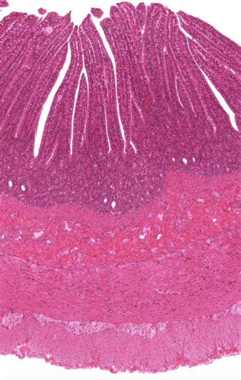 Image result for Small Intestine Jejunum