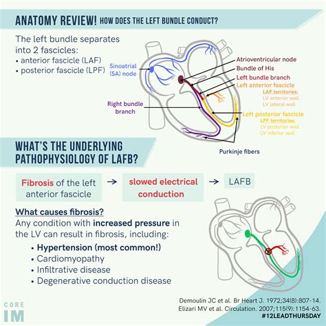 Left Anterior Fascicle