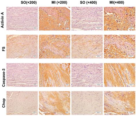 Effects of the Activin A–Follistatin System on Myocardial Cell ...
