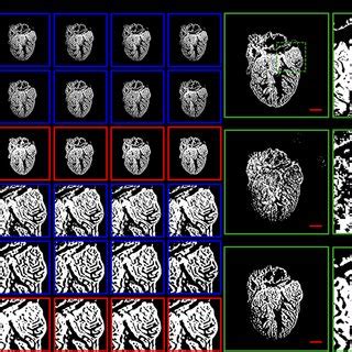 Image result for Overlapping Memory Segmentation