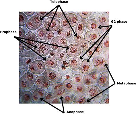 Onion Root Tip Cell Mitosis | 10.3.1: Interphase, Mitosis, and Cytokinesis – WHKRQ