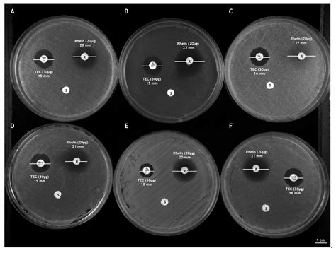 Anthraquinone Rhein Exhibits Antibacterial Activity against ...