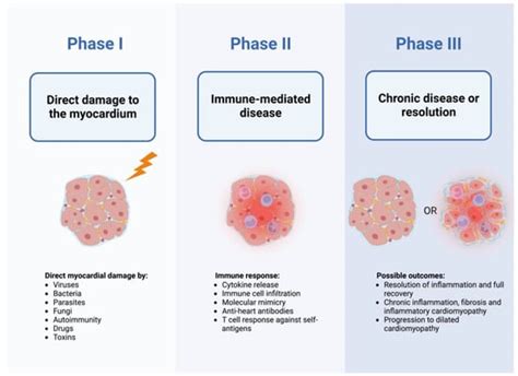 Myocarditis: Etiology, Pathogenesis, and Their Implications in Clinical ...