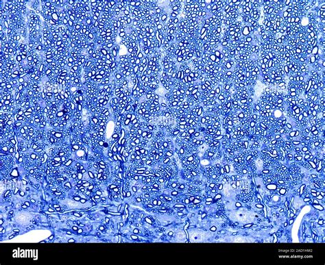 Light microscopy of white matter of the brain. White matter is ...