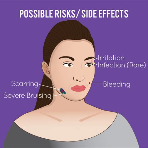 Image result for Thread Lift Problems