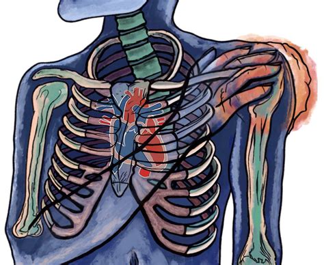Cardiological Signs and Symptoms and Referred Shoulder Pain; A Case ...