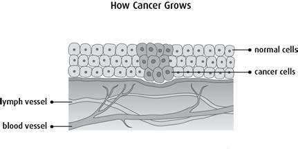 How Does Cancer Develop 的图像结果
