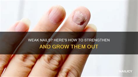 https://nailicy.com/images/resources/how-to-grow-out-weak-nails_20250707120541.webp?utm_source=chatgpt.com