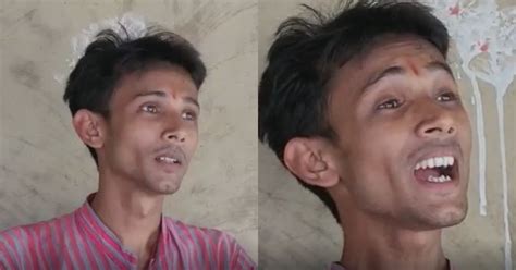 Despite Being Bullied All His Life, Man Born With The Voice Of A Woman ...