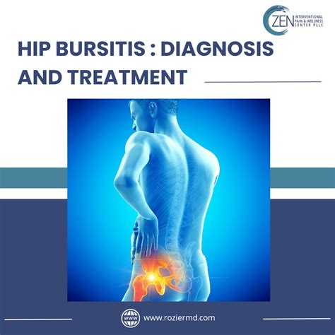 Severe Symptoms Of Hip Bursitis