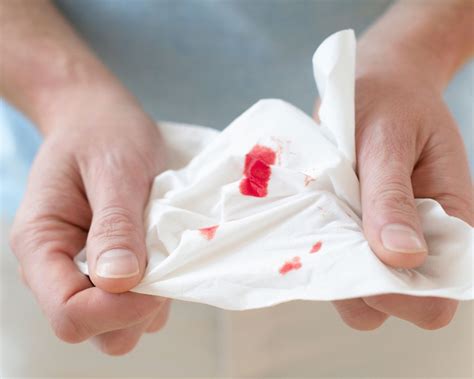 ¿Por qué te sangra la nariz? Todo sobre el sangrado nasal