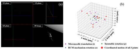 Research and Realization of an OCT-Guided Robotic System for Subretinal ...