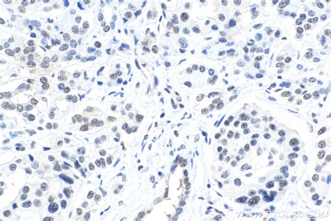 IHCeasy MAP2K1/MEK1 Ready-To-Use IHC Kit KHC1670 | Proteintech