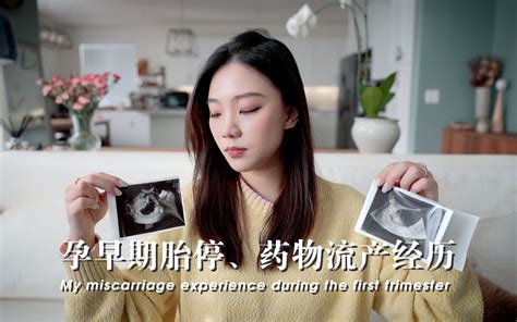 有过胎停育再次胎停几率大专家提醒：这几项抓紧查，生健康宝宝 - YouTube