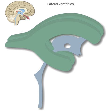 Lateral Ventricle Model Dr. Benaduce: Ventricles Of The Brain