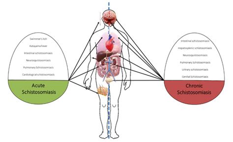Clinical Spectrum of Schistosomiasis: An Update