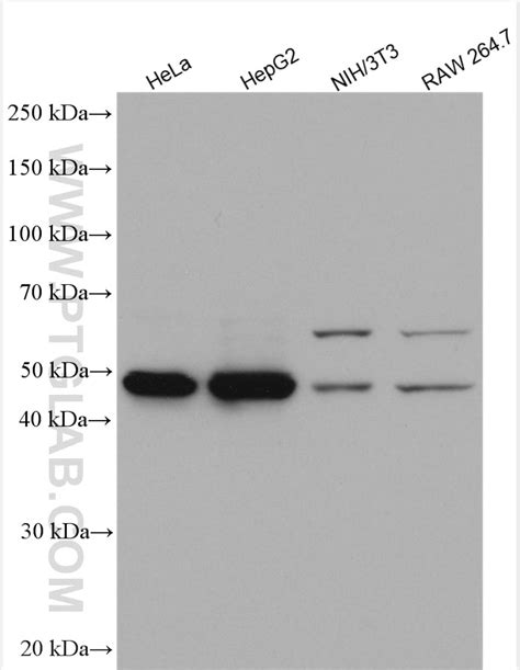 ADSL antibody (15264-1-AP) | Proteintech
