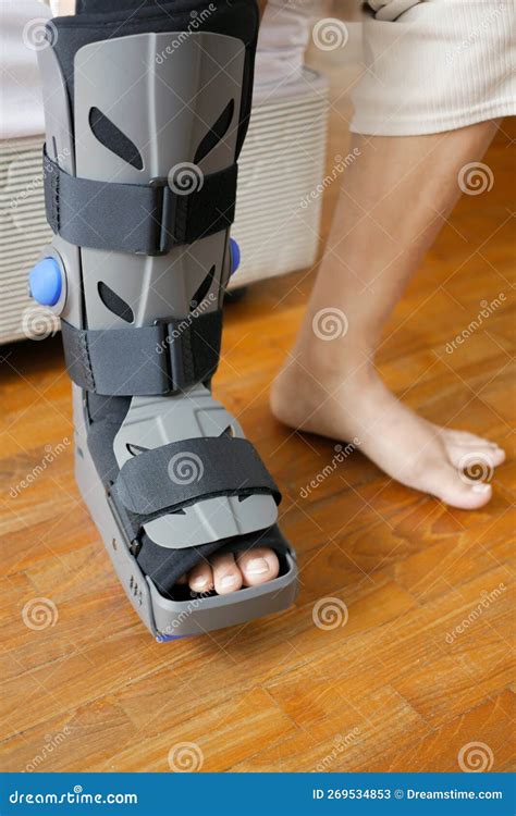 Broken Ankle Cast Or Boot