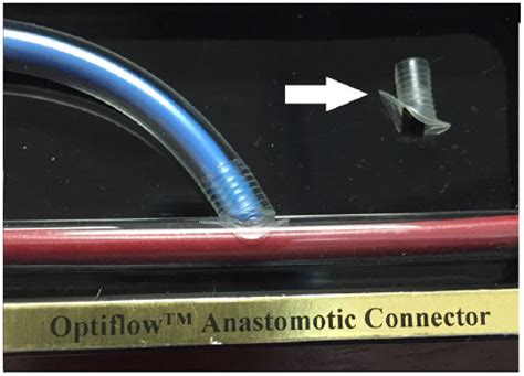 Image result for O2 Optiflow