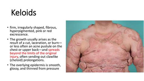 What Is The Keloid