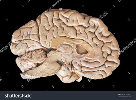 Real Human Brain Anatomy
