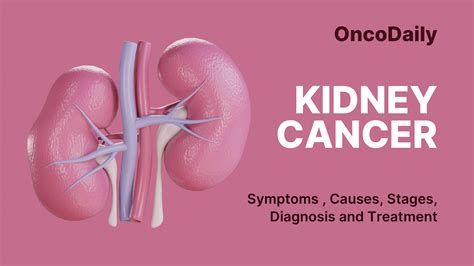 Kidney Cancer: Symptoms ,Causes, Stages, Diagnosis and Treatment - OncoDaily