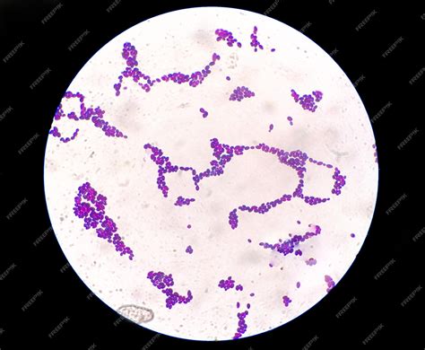 Premium Photo | Gram staining under microscopic view showing Candida ...