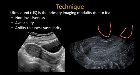 Ultrasound Evaluation of Pelvic Emergencies - A Comprehensive Overview