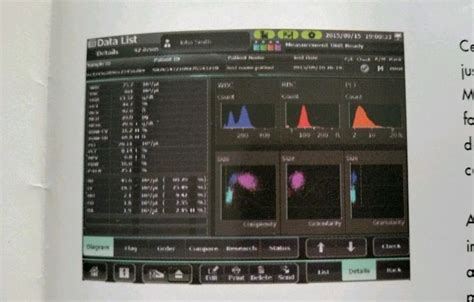 Immunoassay Analyzer - Mek 9100K Fully Automated Hematology Analyzer ...