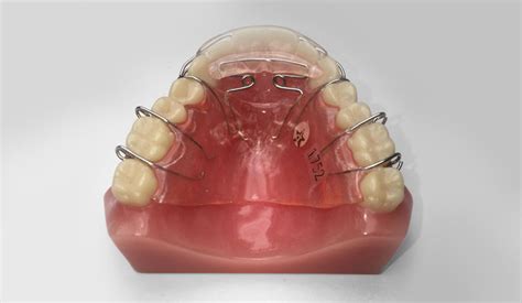 Image result for Compression Spring Retainer