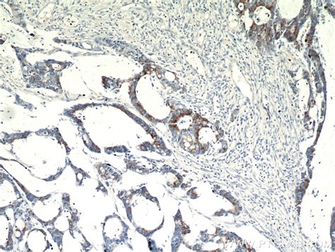 SPRR3 antibody (11742-1-AP) | Proteintech