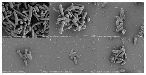 Identification of Lipopeptide Iturin A Produced by Bacillus ...